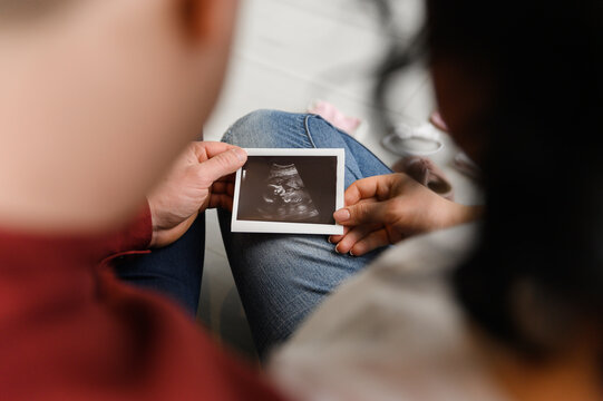 future parents look at the ultrasound of the unborn child. pregnancy of a woman. happy future family. waiting for a baby
