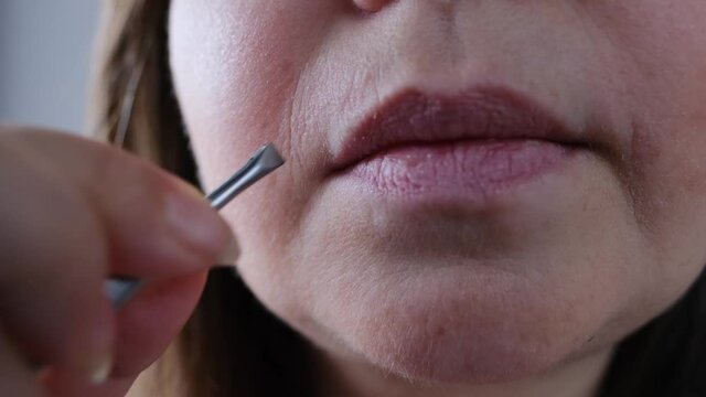 adult woman pulls out, removes with metal tweezers excess hairs on the face near the lips, close-up of the problem of female aging skin, wrinkles, home care concept
