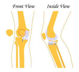 Human knee  leg  front and back view. Vector illustration. Flat design