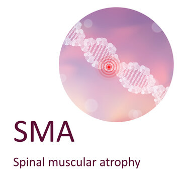 SMA. Spinal Muscular Atrophy. Genetic. DNA Double Helix. Medical Illustration.