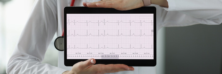 Doctors hands are holding digital tablet with electrocardiogram closeup
