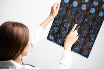 Beautiful female radiologist looking at the MRI scan images