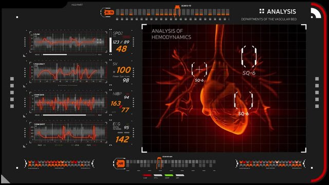 Medical HUD concept. Abstract graphs displays vital signs ECG. Diagrams of human heart rhythm. X-ray scan of the heart with flashing focusing markers and glitch effect. Alpha channel included.