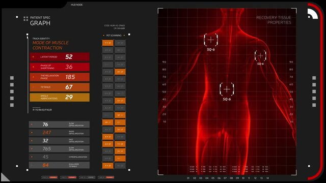 Medical HUD concept. Abstract tables of analyzing the structure of the muscular system. X-ray scan of the human body with flashing focusing markers and glitch effect. Alpha channel included.