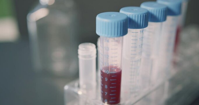 Blood sample in medical tube is placed in a stand next to other tubes