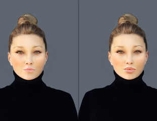 Beauty injections.Concept of rejuvenation.Lip augmentation