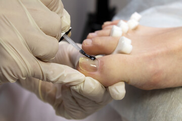 Obraz premium Pedicure. Processing of the foot and toes with milling cutters. Treatment of calluses in a beauty salon by a master. Close-up