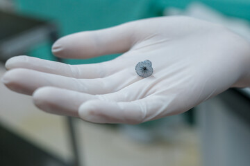 patent ductus arteriosus disease (PDA) device closure , which is congenital heart disease