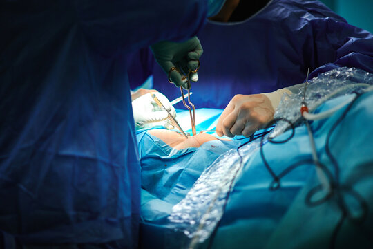Crop anonymous surgeon with assistant in sterile gowns and gloves using needle holders while suturing incision during operation in modern clinic