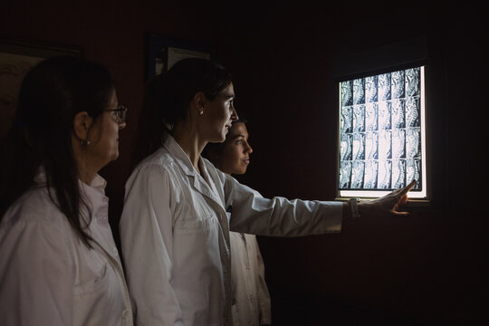 A group of female doctors are looking a x-ray in a dark room with the light off and one is pointing it