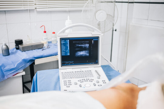 Ultrasound machine on a table with a blue cloth next to a patient lying on a stretcher in a hospital