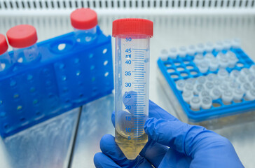 Close-up, a scientist examines a large test tube of yellow liquid, which he holds in his hand...