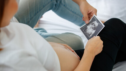 happy family, healthy baby concept. Photo of a hand of a man and woman holding and looking on ultrasound scan photo of their fetus. Selective focus on a scan photo
