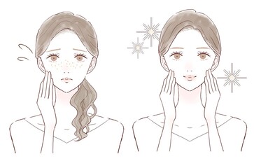 そばかす　女性　ビフォーアフター
