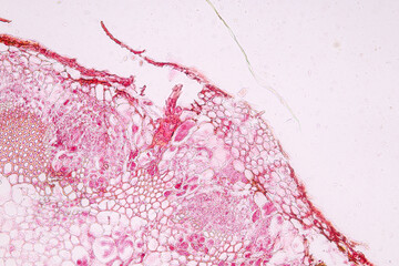 Characteristics of fungi living in wood as a group, are polyphyletic under the microscope for...