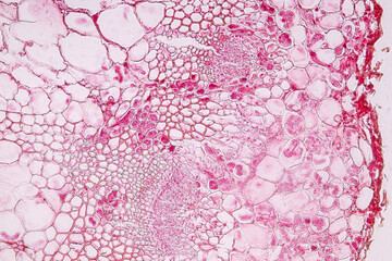 Characteristics of fungi living in wood as a group, are polyphyletic under the microscope for education.
