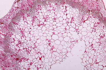 Characteristics of fungi living in wood as a group, are polyphyletic under the microscope for...