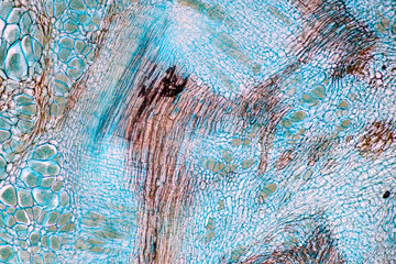 Characteristics of fungi living in wood as a group, are polyphyletic under the microscope for...