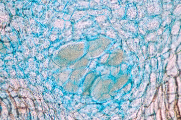 Naklejka premium Characteristics of fungi living in wood as a group, are polyphyletic under the microscope for education. 