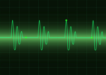 Monitor heart beats cardiogram loop on green graph screen background, medical and science vector design concept