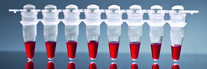 Sripe of plastic tubes with samples for DNA analysis by PCR