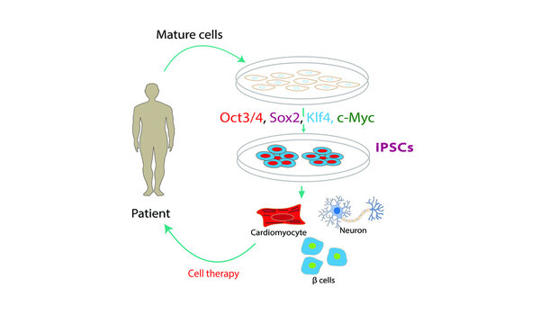 IPSCs [Induced Pluripotent Stem Cells]