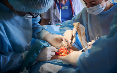 Doctors performing abdominoplasty surgery in operating room.