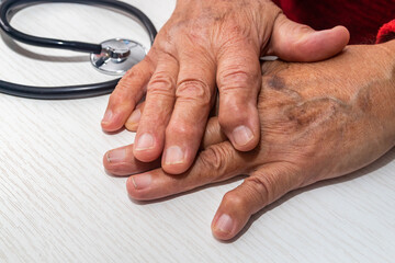 Hand of elderly man with osteoarthritis at doctor's office on white table