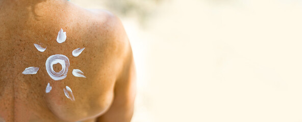 Young woman with sun shaped suntan lotion on her back at the beach. Girl shoulder applying protection cream before sunbathing.