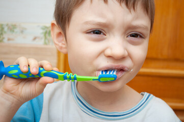 the child does not want to brush his teeth