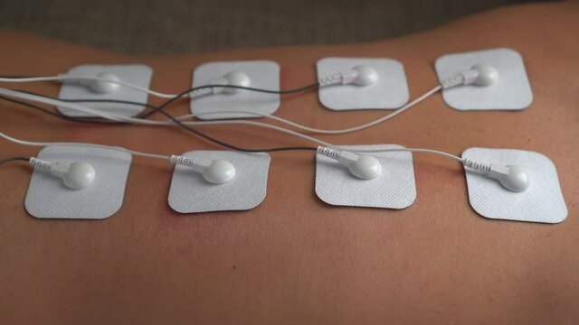 Woman doing electrical stimulation massage on her back Tens. Physiotherapeutic procedures, massage and restoration with an electric device