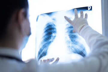 Pulmonologist looking at lung x-ray prescribing treatment to patient, healthcare - Powered by Adobe