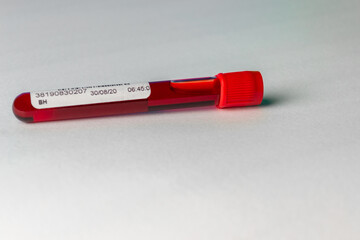 tubo de sangre 2