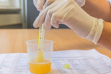 Close-up of a person doing an urine check
