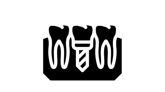 implant check glyph icon animation