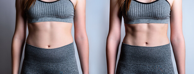 Young woman before and after loosing fat on gray background. - obrazy, fototapety, plakaty