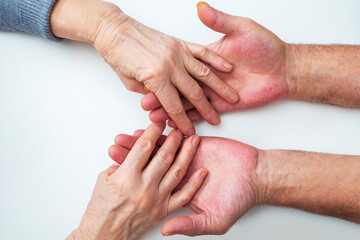 Elderly couple in love holding hands. Concept assistance, patronage and support. National Senior Citizens Day. Adult romantic married couple.