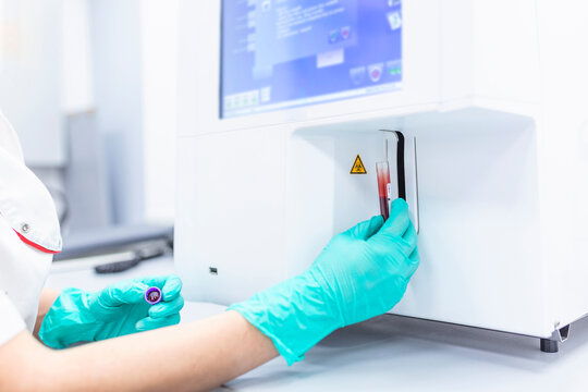 Lab technician holding blood in EDTA tube for test complete Blood Count (cbc) testing hematology laboratory. Scientific medical test with automated hematology analysis.