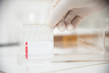 Test tube in laboratory testing.