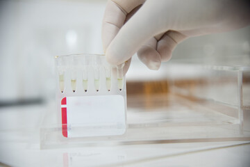 Test tube in laboratory testing.