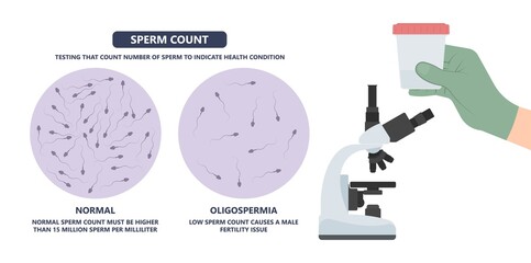 in vitro fertilization IVF semen test sample sperm count type Male biopsy fertility collect Low Poor Zero head anatomy midpiece tail birth control blocked defect abnormal ejaculate vas Non dry