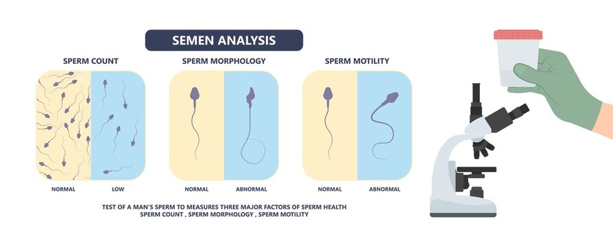 in vitro fertilization IVF semen test sample sperm count type Male biopsy fertility collect Low Poor Zero head anatomy midpiece tail birth control blocked defect abnormal ejaculate vas Non dry