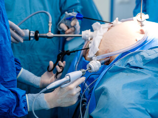 A surgeon in latex gloves and a blue uniform holds special medical instruments during a laparoscopic operation. Treatment of proctological diseases.