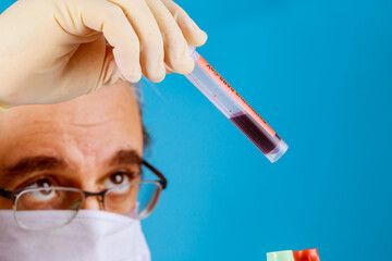 Laboratory technician holding a hand with blood sample