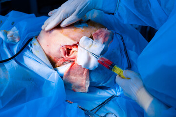 Macs lift surgery. Minimal Access Cranial Suspension Lift plastic operation in medical clinic. Correction face form for old woman