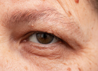 Obraz premium wrinkles around the eyes on a woman's face