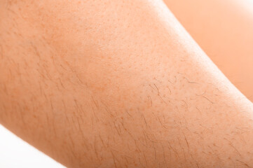 Epilated area of the skin on the background of long hair. Removal of unwanted hair Close-up