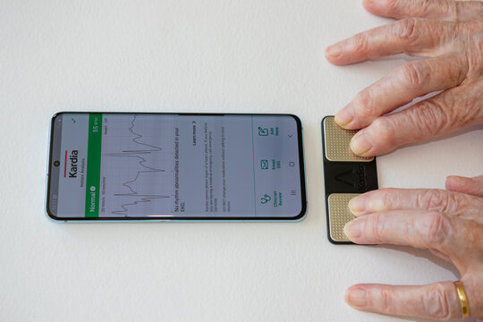 Ekg ecg electrocardiogram graph displayed on smartphone using Kardia Alivecor app and paired electrodes. Use of smart technology at home for health