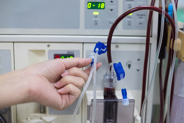 Dialysis machine is working. Acting as a substitute for the kidneys to drive waste from the body.	