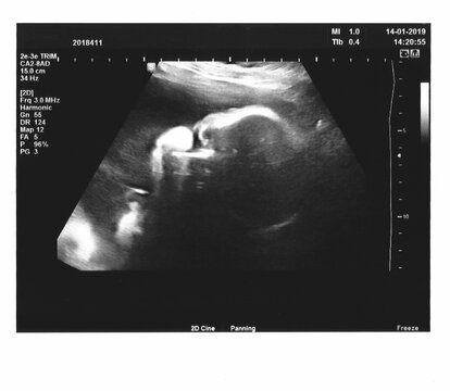 Dreamy ultrasound close-ups